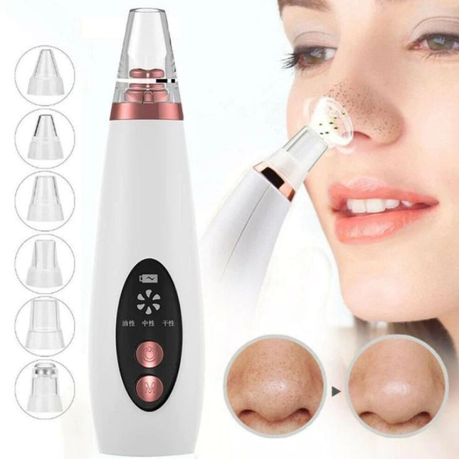 4 in 1 Blackhead Remover