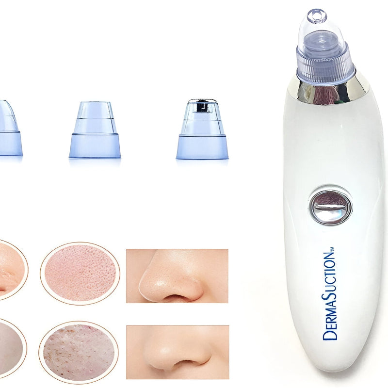 4 in 1 Blackhead Remover