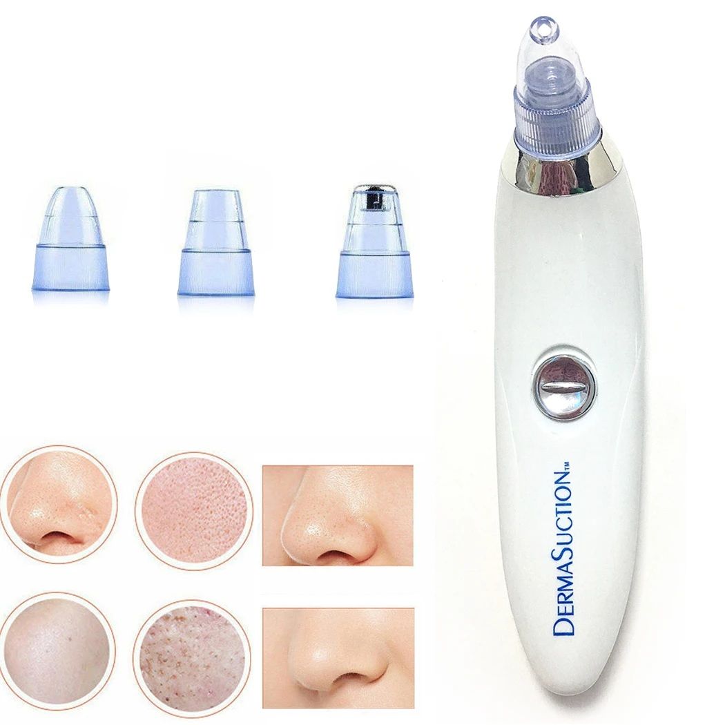 4 in 1 Blackhead Remover